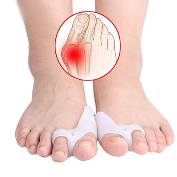 1 Pair Silicone Toe Corrector Instantly Improve Foot Health and Comfort with Hallux Valgus Buffer Toe Separator - Image 2