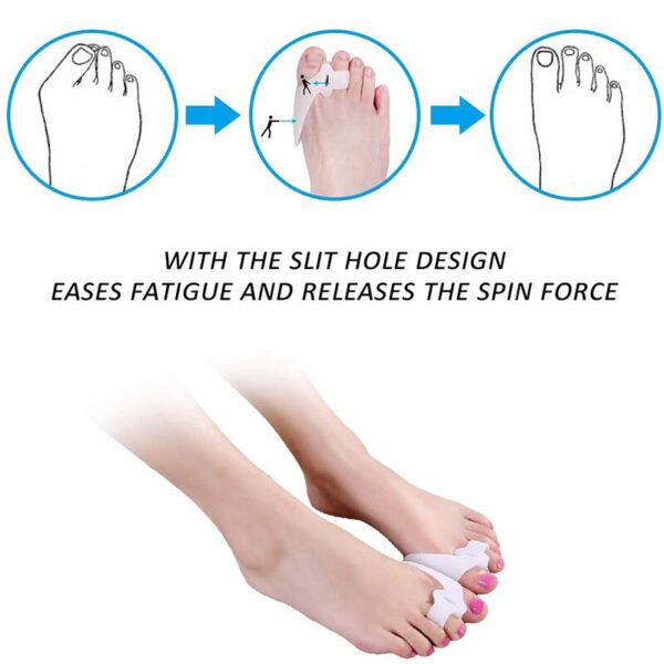 1 Pair Silicone Toe Corrector Instantly Improve Foot Health and Comfort with Hallux Valgus Buffer Toe Separator - Image 5