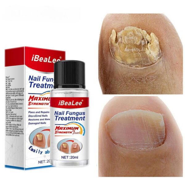 For Nail Fungal Treatment Feet Care Essence Extra Strong Nails Repair Foot Toe Nail Fungus Removal Gel Beauty Health Care