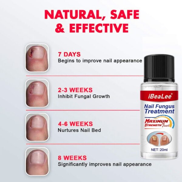 For Nail Fungal Treatment Feet Care Essence Extra Strong Nails Repair Foot Toe Nail Fungus Removal Gel Beauty Health Care - Image 4