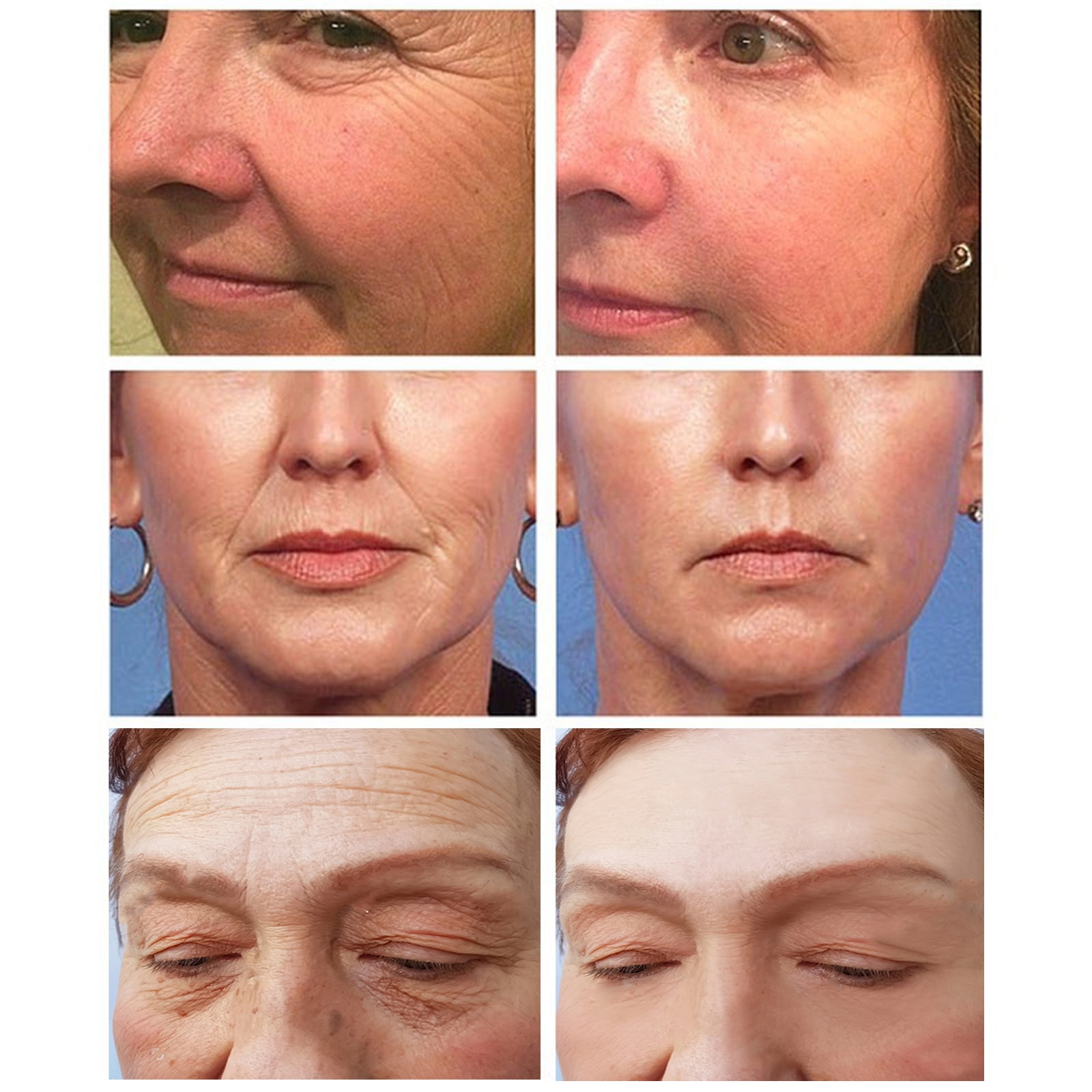 Instant Wrinkle Remove Serum Retinol Lifting Firming Anti Aging Essence Fade Fine Lines Whitening Face Skin Care Korea Cosmetic - Image 2